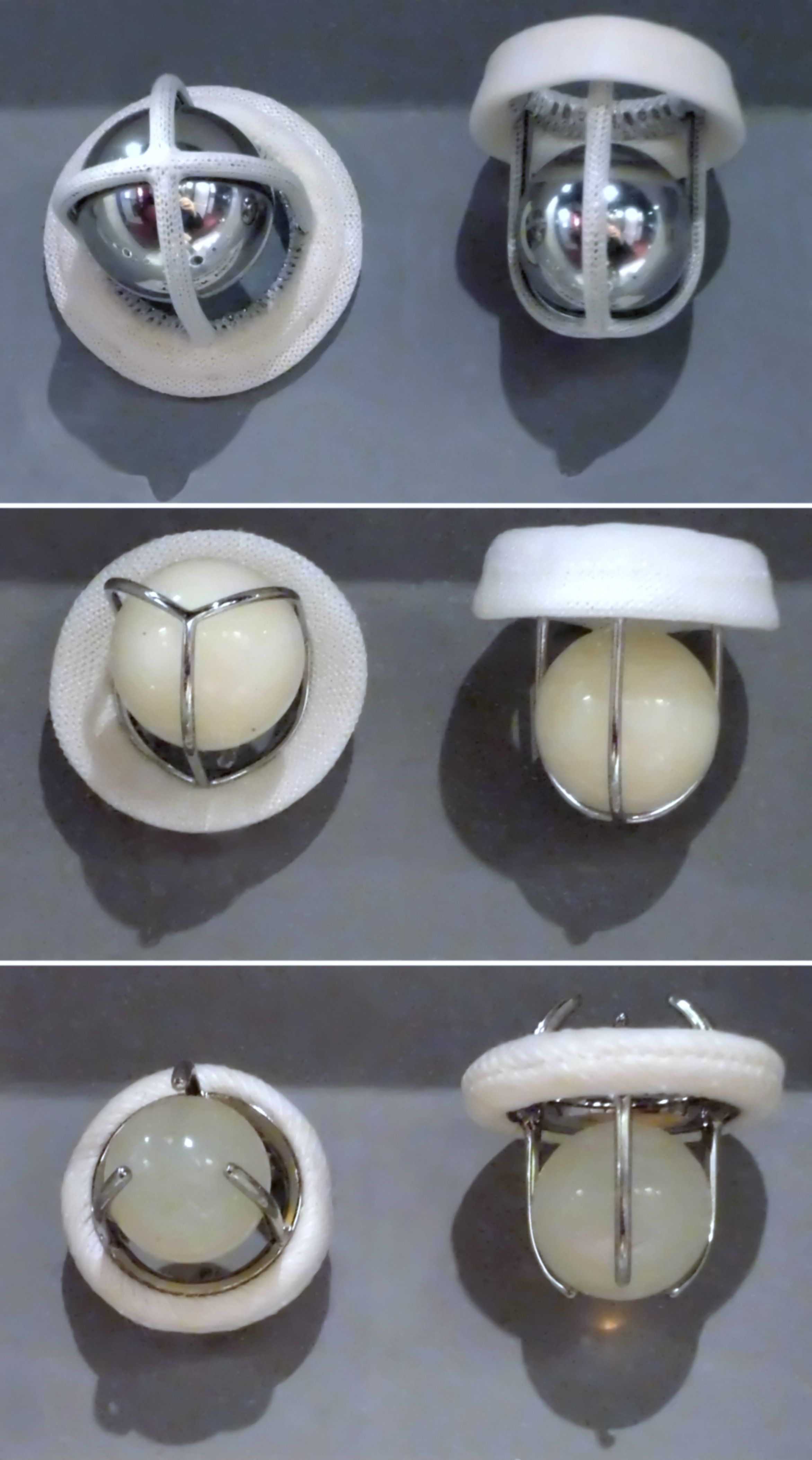 Prosthetic Cardiac Ball Valves.jpg
