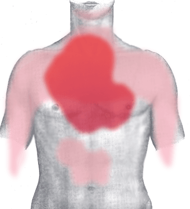 AMI Pain Front