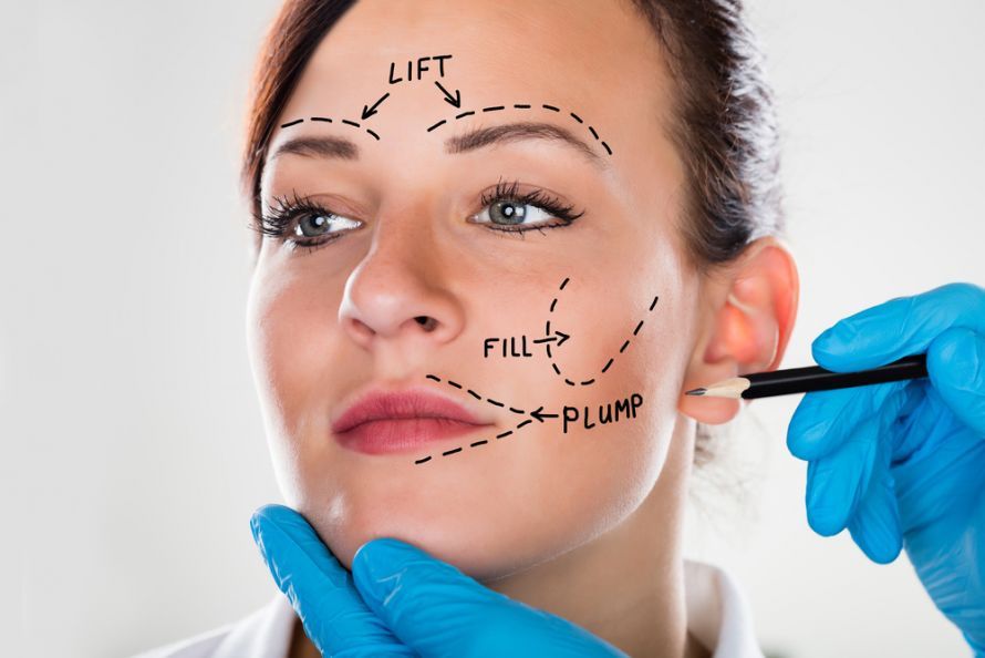 Facelifting