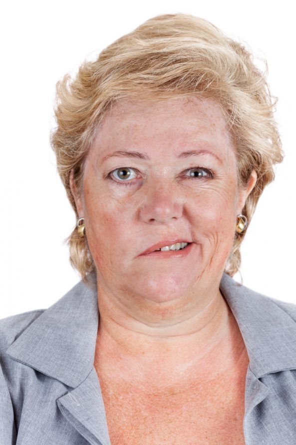 Frau mit Fazialparese Woman with facial paralysis