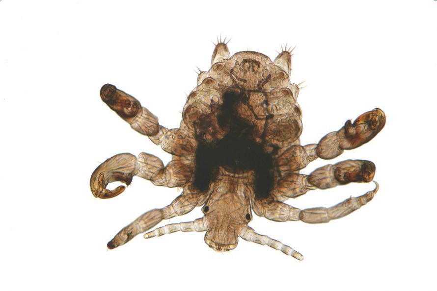 Close-up of a pubic louse