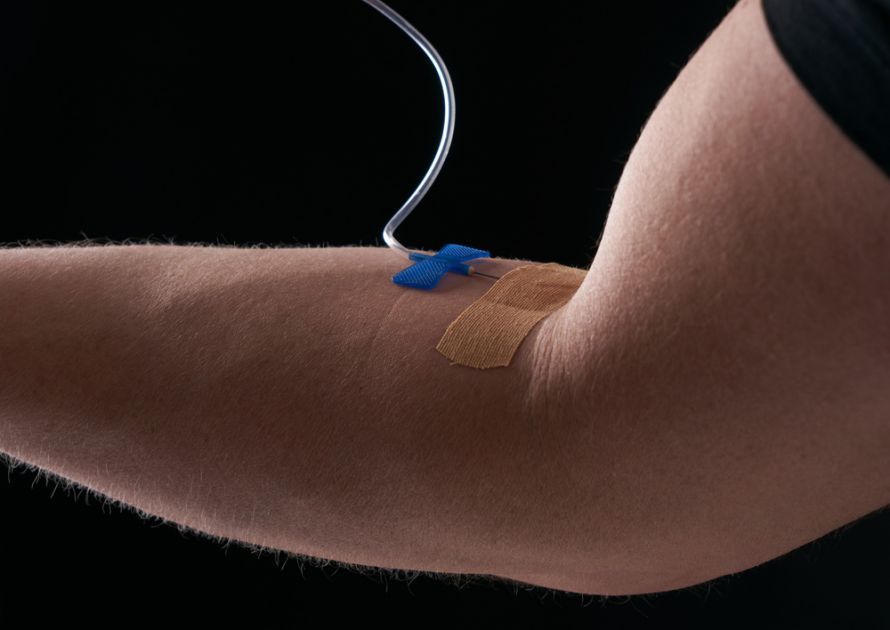 Pain catheter