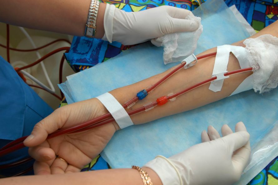Dialyseshunt Dialyseshunt