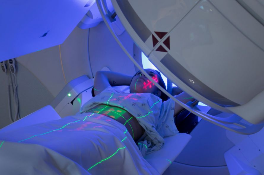 Strahlentherapie bei Krebs Strahlentherapie bei Krebs