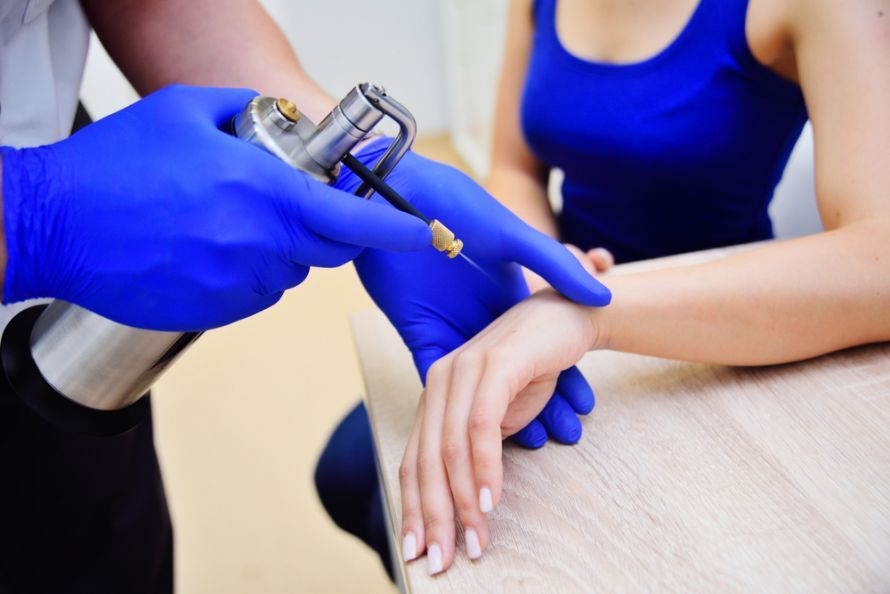 Kryotherapie bei Flachwarzen