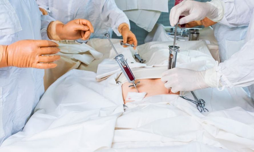 Bone Marrow Transplant