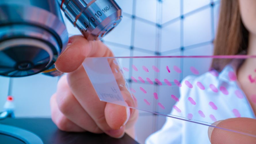 Laboruntersuchung nach Brust-Biopsie Laboruntersuchung nach Brust-Biopsie