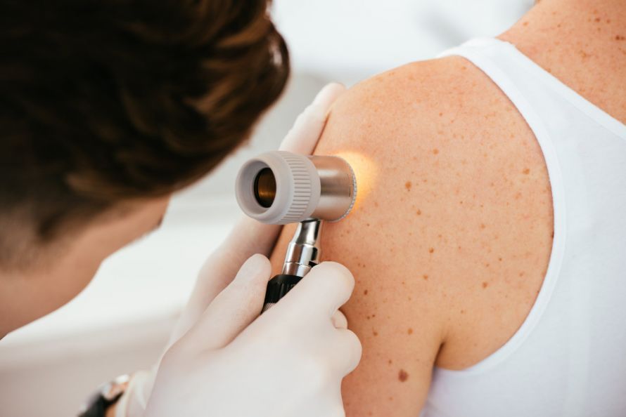Hautkrebsvorsorge mit einem Dermatoskop Hautkrebsvorsorge mit einem Dermatoskop