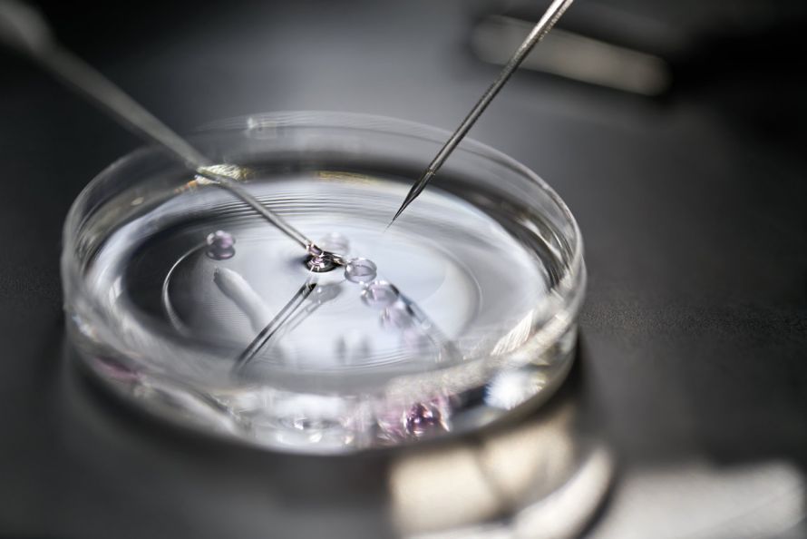 In Vitro Fertilization (IVF)
