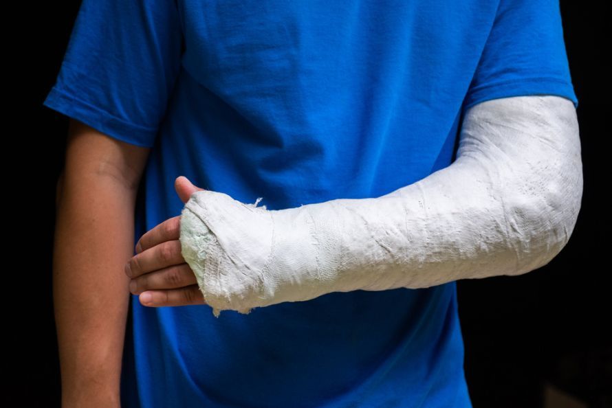 Gips bei Ellenbogenfraktur Γύψος σε περίπτωση κατάγματος αγκώνα