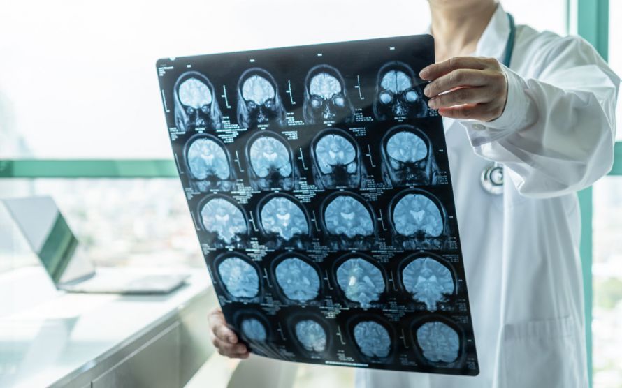 Gehirn im MRT Brain on an MRI