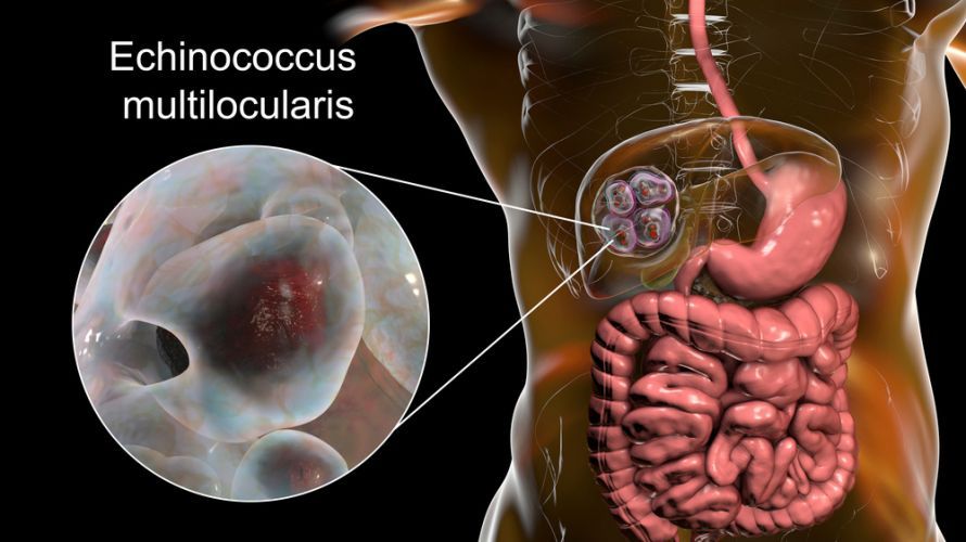 Echinococcus multilocularis