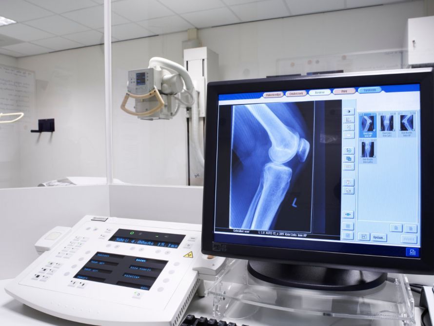 Knee on an X-ray