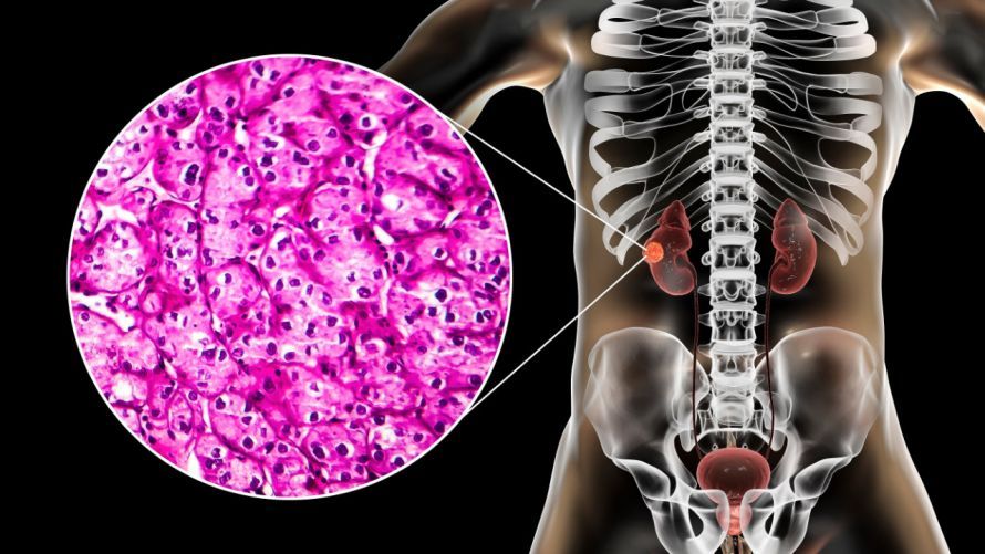 Lage der Nieren und Histologie Θέση των νεφρών και ιστολογία
