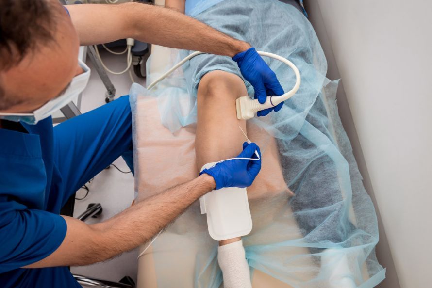 Radiofrequenzablation in der Kardiologie