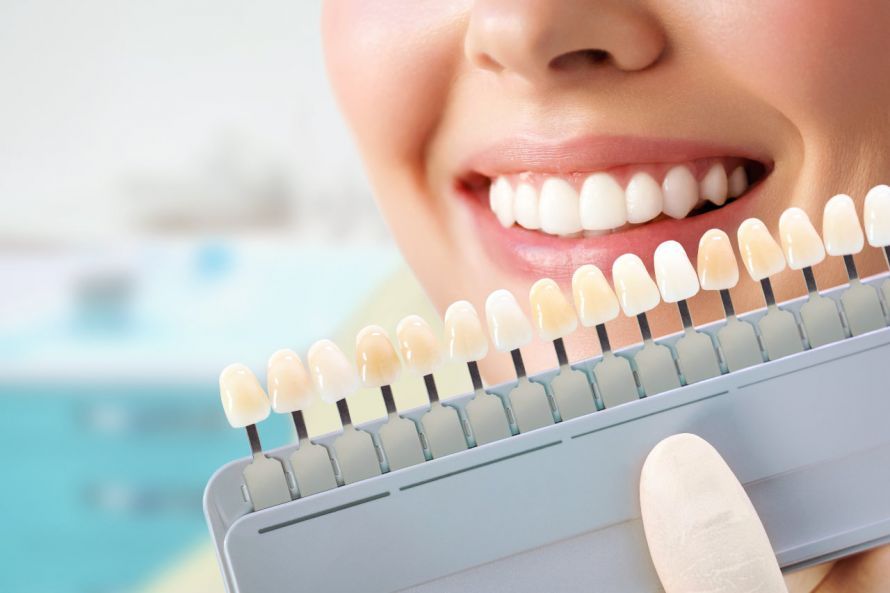 Choosing the Color of Dental Prosthetics