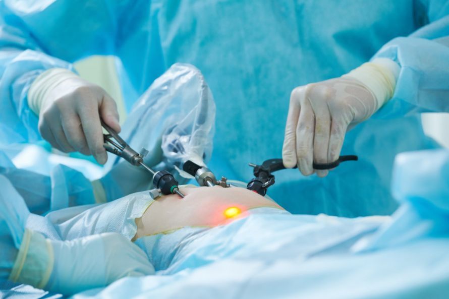 Minimal-invasive OP Minimal-invasive OP