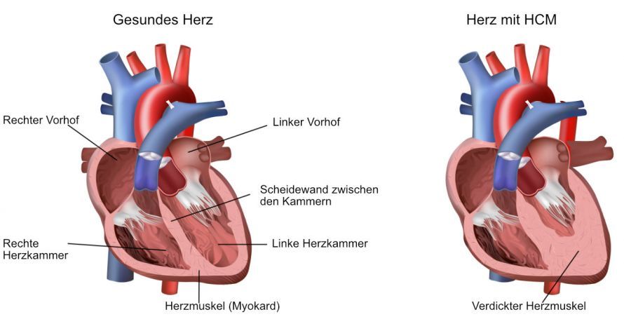 HCM HCM