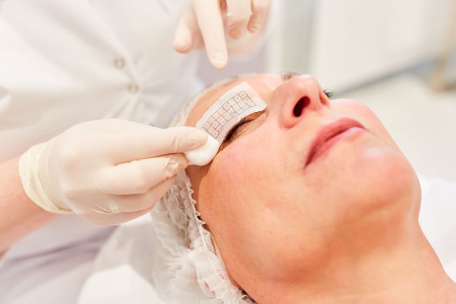 Thermage-Behandlung mit Raster Θεραπεία Thermage με πλέγμα