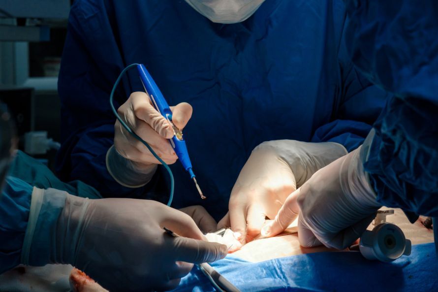 Elektrokoagulation in der Hochfreqzenz-Chirurgie Elektrokoagulation in der Hochfreqzenz-Chirurgie