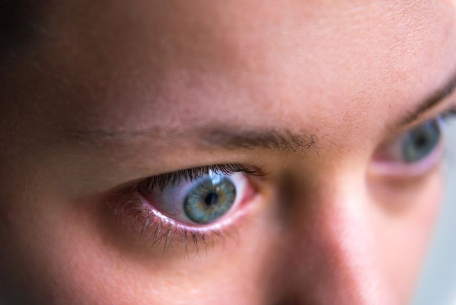 Protruding eyeballs in endocrine orbitopathy