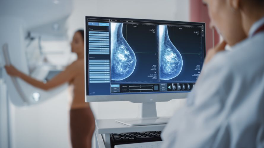 Mammography for Galactorrhea
