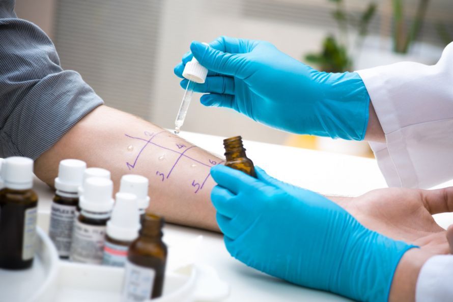 Pricktest zur Abklärung von Kontaktallergien Pricktest zur Abklärung von Kontaktallergien
