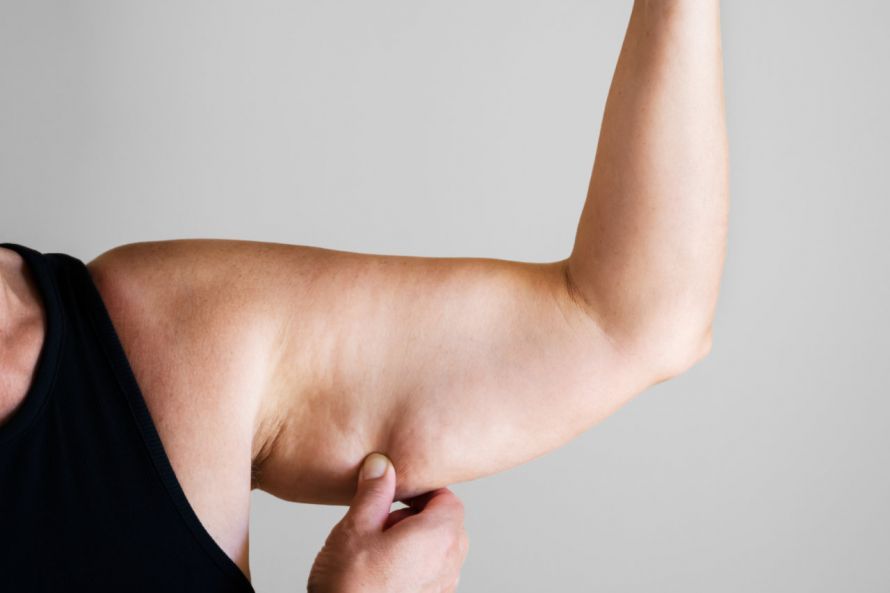 Schlaffe Oberarme Flabby Upper Arms