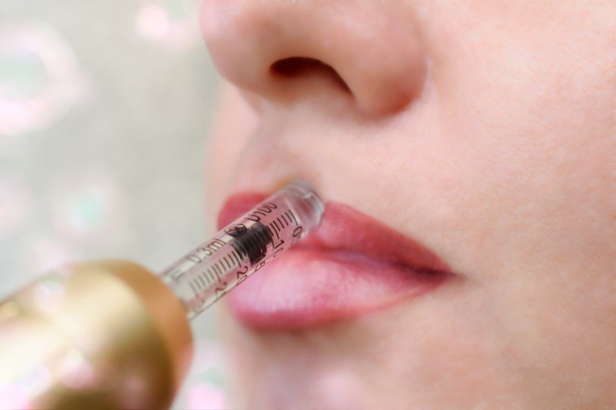Injektion bei einer Lippenvergrößerung Injektion bei einer Lippenvergrößerung