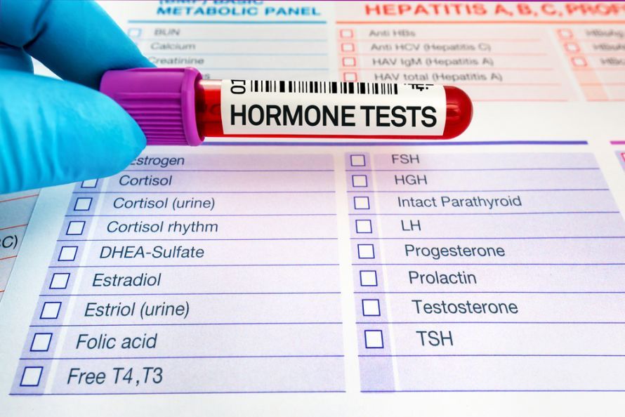 Hormondiagnostik aus Blutabnahme Hormondiagnostik aus Blutabnahme