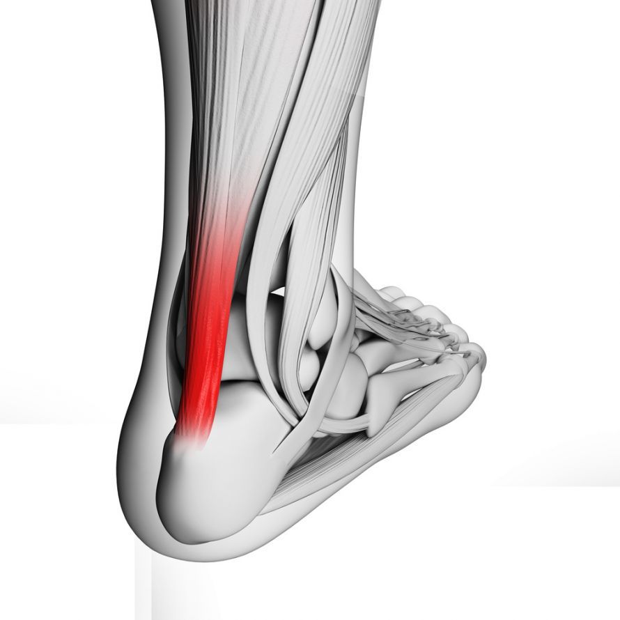 Achillessehne Achilles tendon