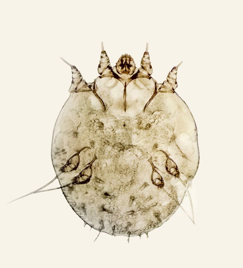 Sarcoptes scabiei mite