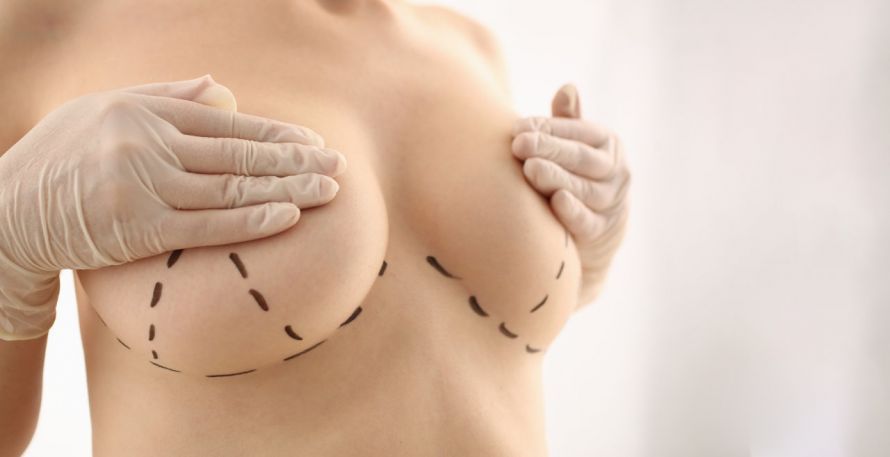 Breast Augmentation