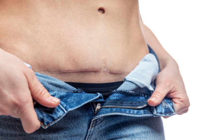 Viszeralchirurgie