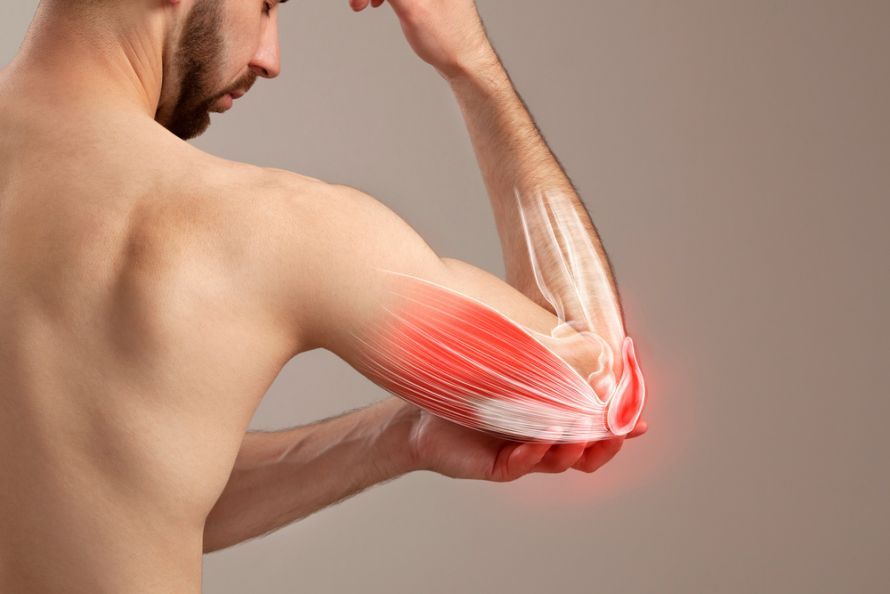 Armsehnen Arm tendons
