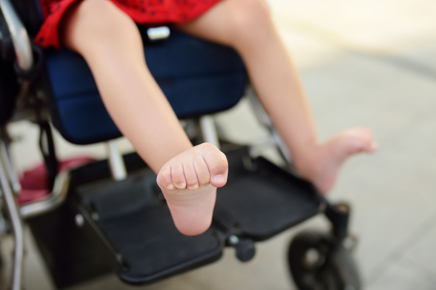 Infantile Cerebralparese