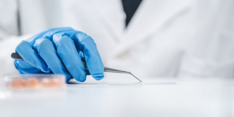 Biopsie Biopsy
