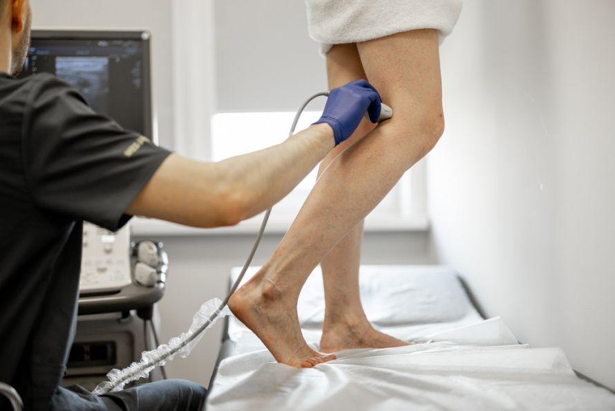 Radiofrequenztherapie bei Krampfadern