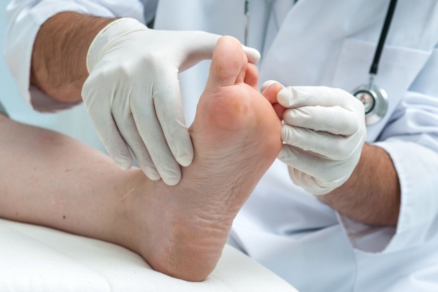 Untersuchung der Zehenzwischenräume bei der Fußpilz-Diagnose Examination of the spaces between the toes in the diagnosis of athlete's foot