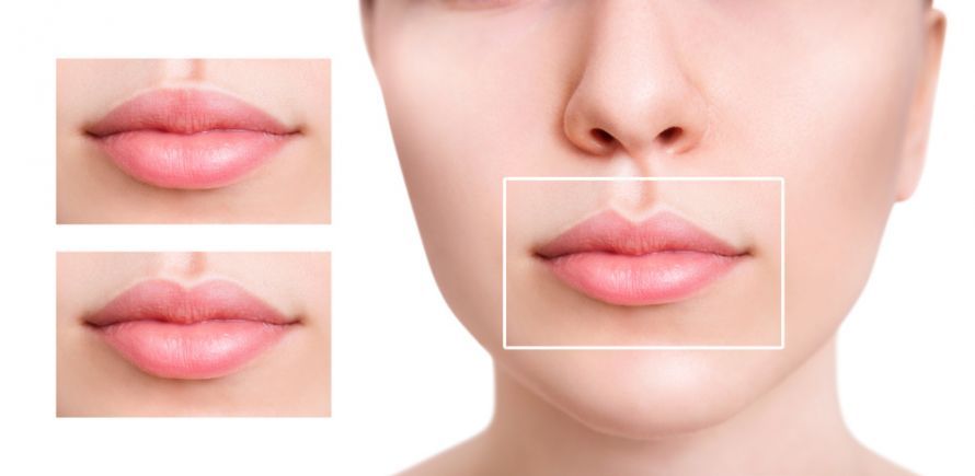 Lip Contouring