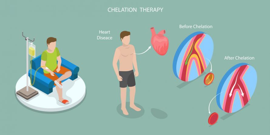 Chelattherapie