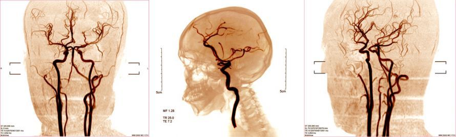 Angiografie