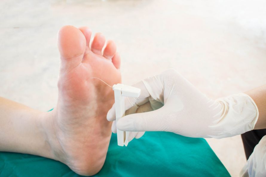 Diagnostik an einem diabetischen Fuß Διαγνωστικές εξετάσεις για το διαβητικό πόδι
