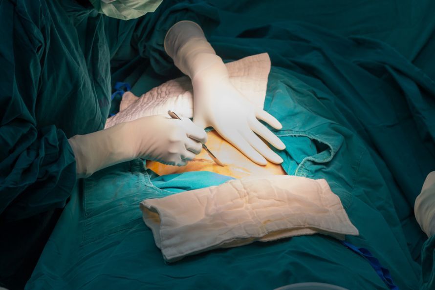 Emergency Cesarean Section