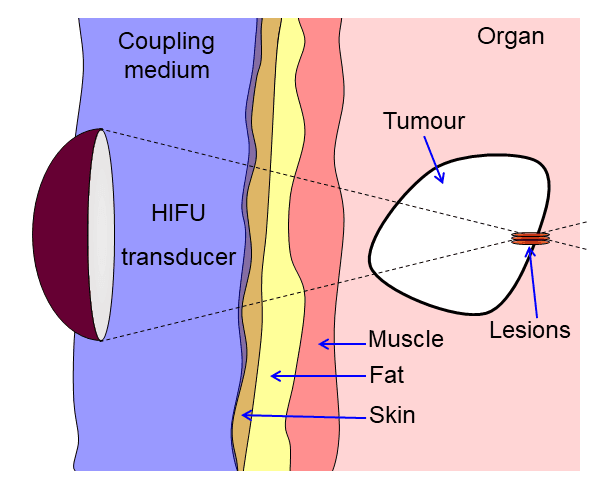 Prof. Planz Diagramm