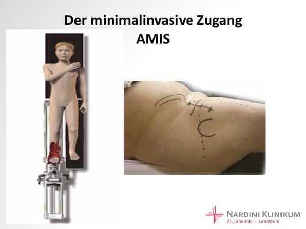 Foto Extensionstisch Foto Extensionstisch