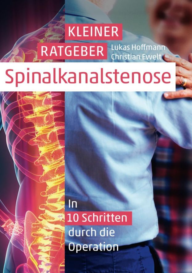 A Short Guide to Spinal Canal Stenosis: A 10-Step Guide to Surgery by Lukas Hoffmann (Author), Christian Ewelt (Author)