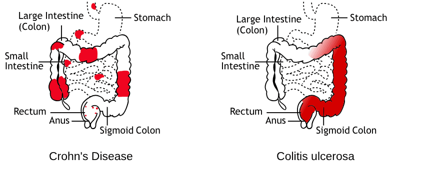Comparison Chart