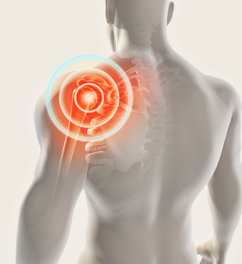Shoulder pain
