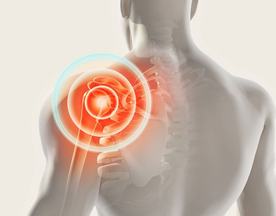 Schmerzen in der Schulter Shoulder pain